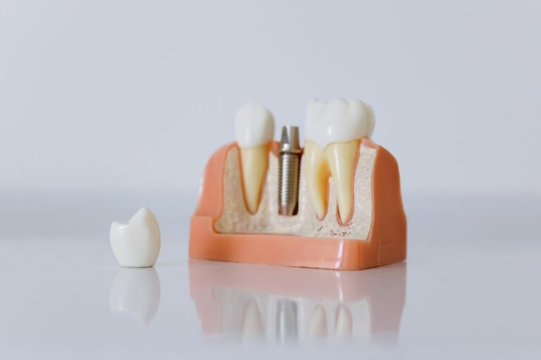 implantes dentales precio